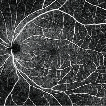 AngioScan(可選軟件) AngioScan(可選軟件)