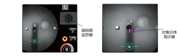 配備監控器和指示器 配備監控器和指示器