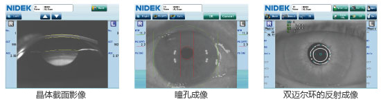 眼前節觀測 眼前節觀測
